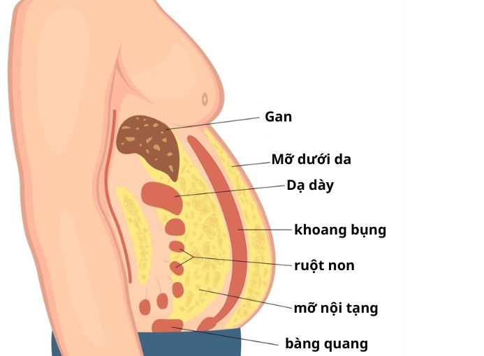 mo-noi-tang-17829110683001244915789 Mỡ nội tạng nguy hiểm hơn mỡ dưới da như thế nào? - Ảnh 1.