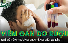 Cuộc Hành Trình Đau Khổ Của Người Đàn Ông Mang Ấu Trùng Sán Dây Trong Cơ Thể