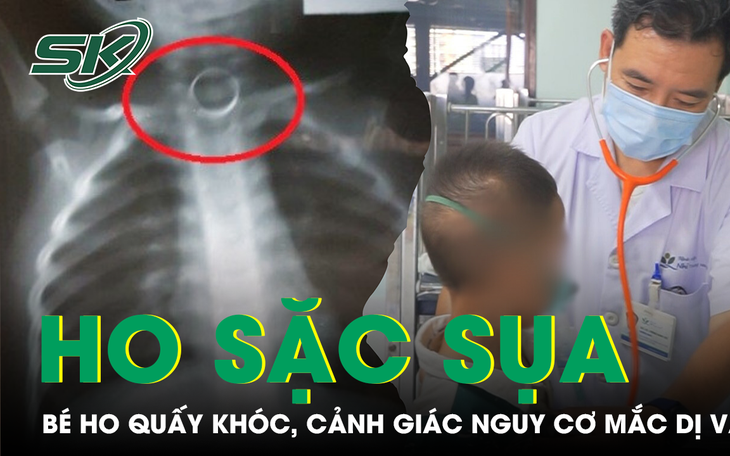 Bà Mắc Dị Vật Trong Khí Quản Sau Khi Ăn Cá- Ảnh 3.