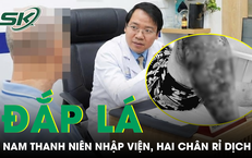 Khám Phá Những Loại Cá Tiết Kiệm Đầy Dưỡng Chất mà Bạn Nên Thử