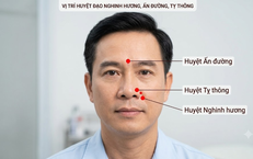 Khám Phá 5 Món Canh Bổ Dưỡng Từ Củ Sen