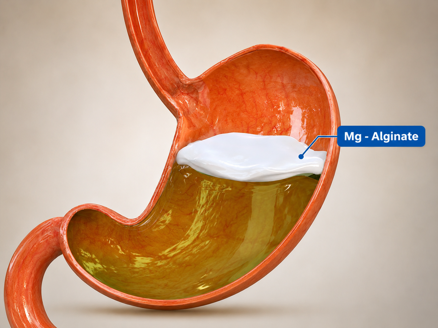 1-1787969710848839127854 Giải pháp lớp gel 'bè nổi': Xu hướng trong kiểm soát trào ngược ở trẻ nhỏ- Ảnh 1.