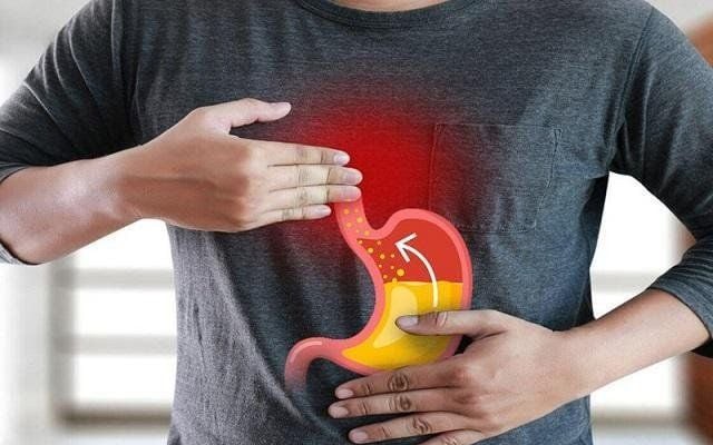 Khám Phá Trào Ngược Dạ Dày – Thực Quản: Nhận Diện và Phòng Ngừa Hiệu Quả