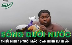 Những Điều Cần Biết Về Suy Thận Và Thói Quen Ăn Uống Nguy Hiểm