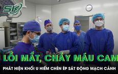 Câu Chuyện Về Một Người Đàn Ông Gặp Rắc Rối Với Ong Vò Vẽ Khi Đi Bắt Cá