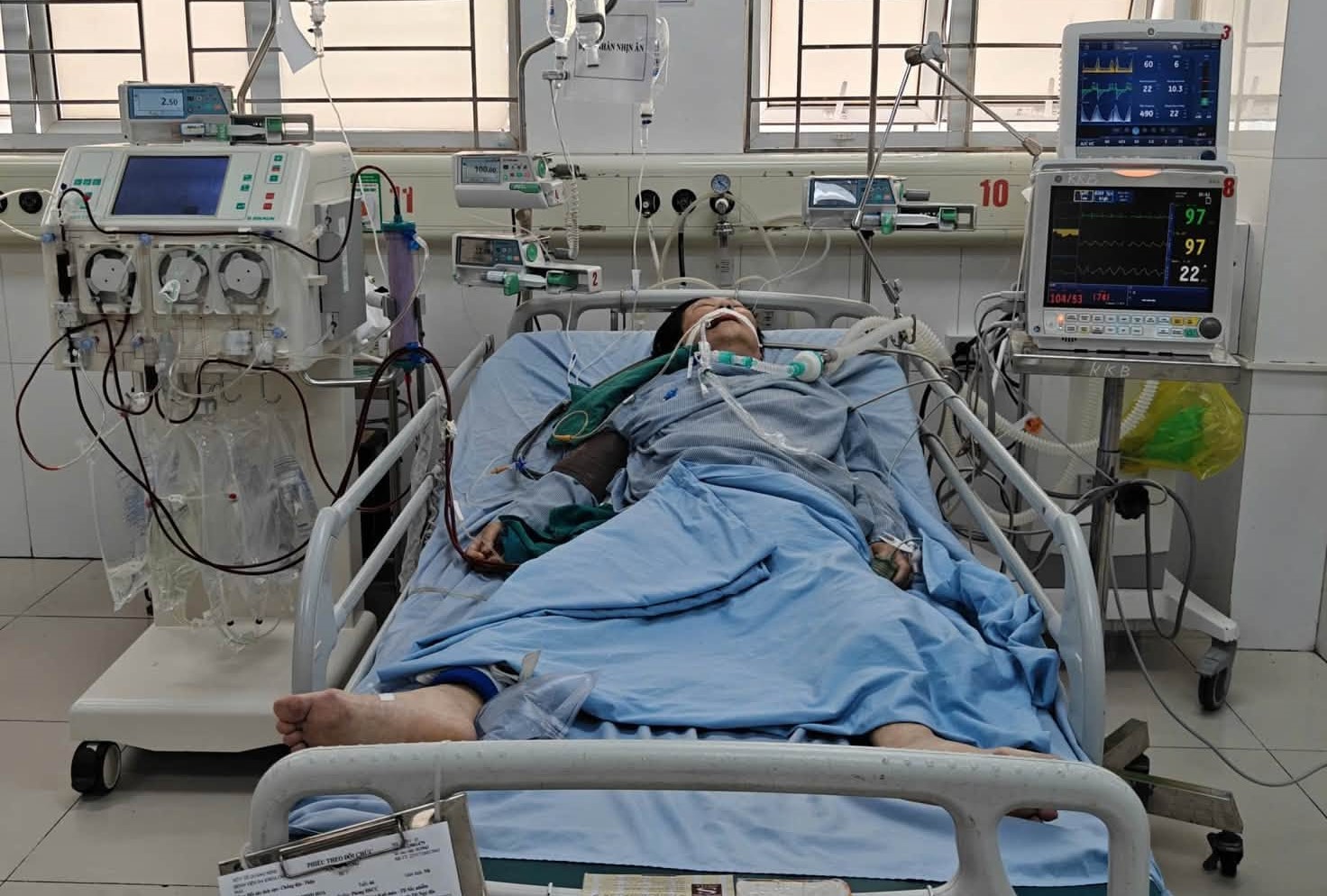 5-178653296503596505048 Hành Trình 23 Ngày Chiến Đấu Với Sốc Nhiễm Khuẩn- Ảnh 1.