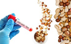 Đau Nửa Đầu và Kỳ Kinh: Lời Giải Thích Về Mối Quan Hệ Thú Vị