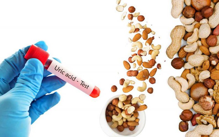 Nguy Cơ Tăng Acid Uric Ở Người Trên 50: Mất Nước Khi Tập Thể Dục - Ảnh 1.