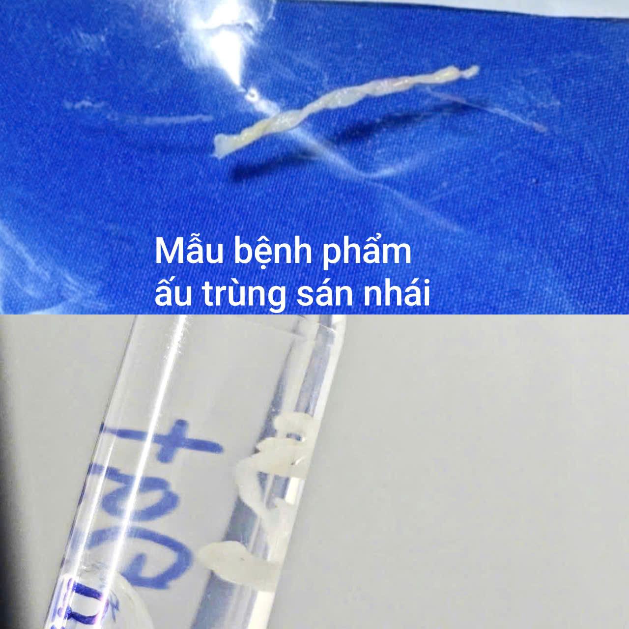 Những Nguy Cơ Tiềm Ẩn Khi Uống Nước Suối Tự Nhiên- Ảnh 2.