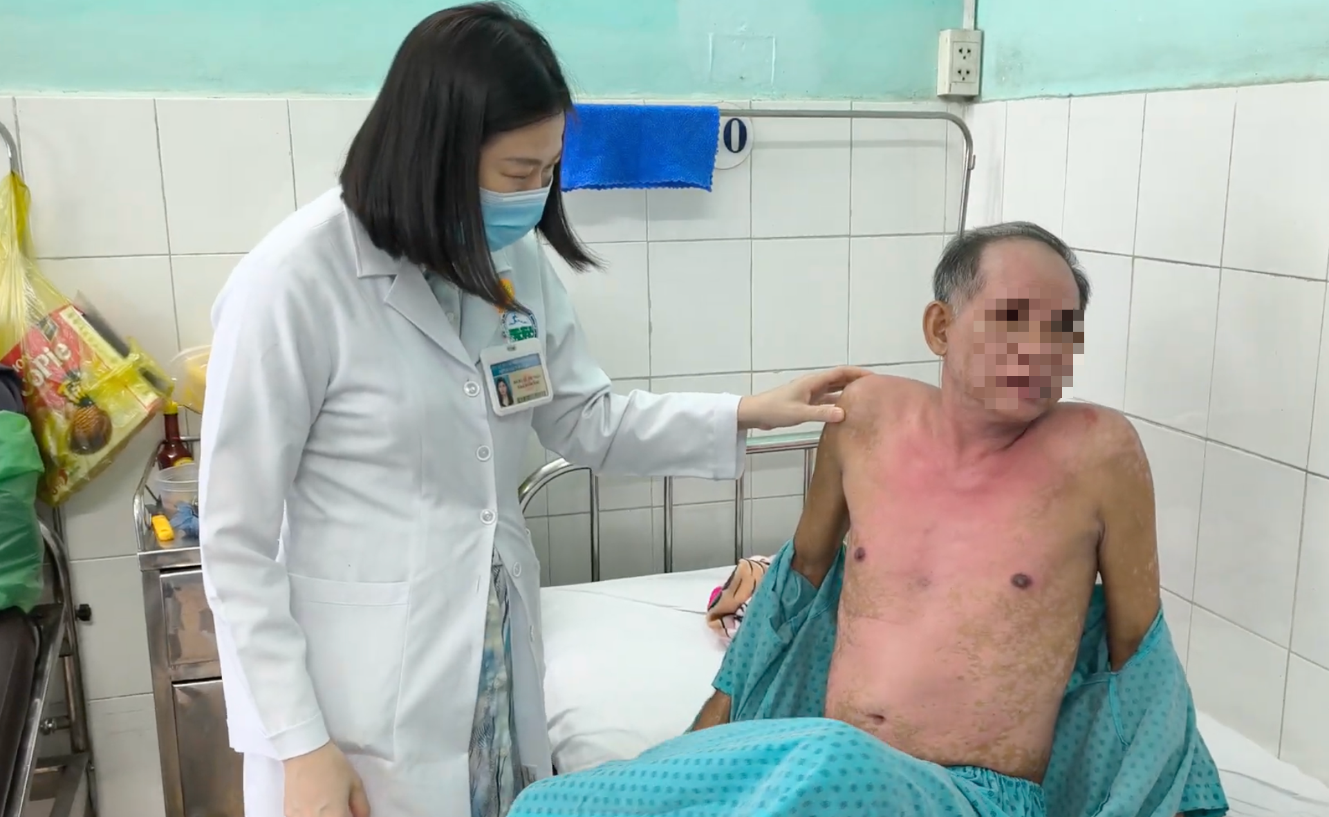 Cảnh Báo Dị Ứng Thuốc Nhỏ Mắt: Hậu Quả Nghiêm Trọng Đối Với Sức Khỏe