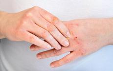 Khám Phá Tuổi Thọ của Người Nhiễm HIV: Sự Thật và Thực Tế