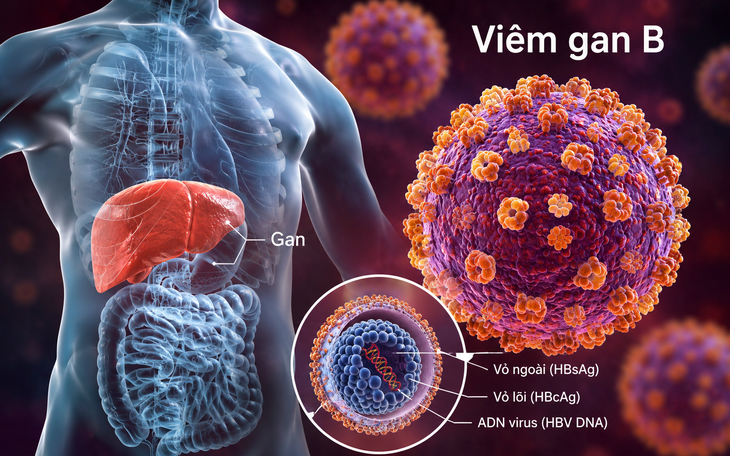 Vì sao viêm gan B và C vẫn gây tử vong dù đã có vaccine và thuốc điều trị? - Ảnh 2.