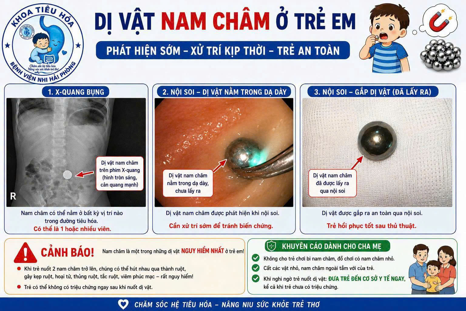 di-vat-nam-cham-o-tre-178572646312941325243 Bác sĩ khuyến cáo không cho trẻ chơi bi nam châm để tránh dị vật nguy hiểm - Ảnh 1.