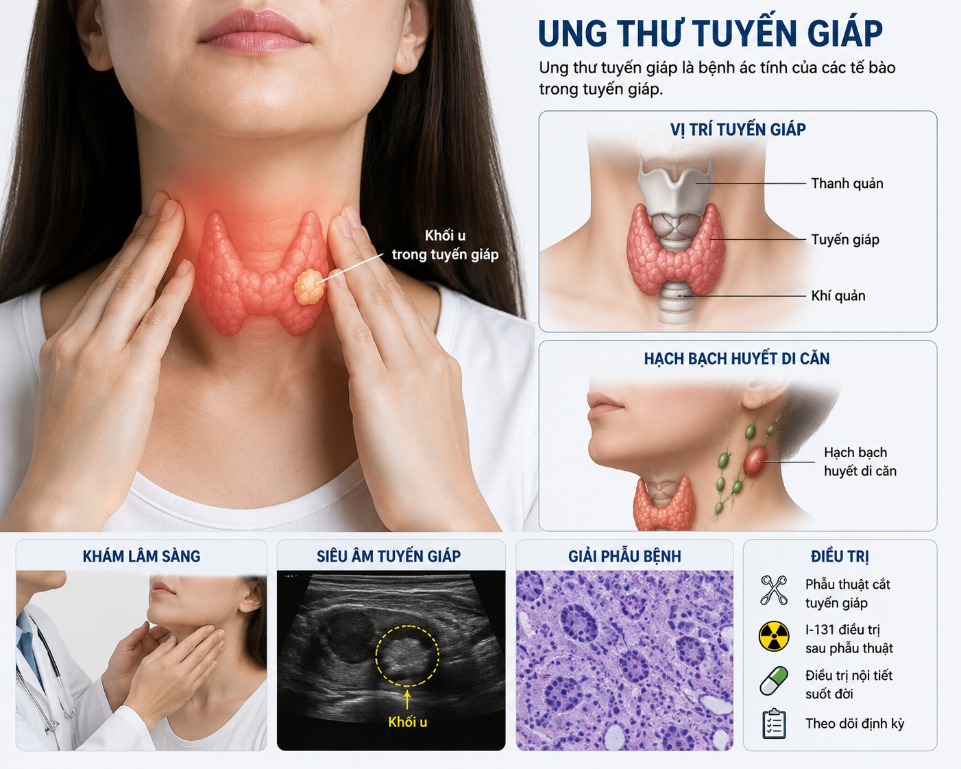 Sau mổ ung thư tuyến giáp, ai cần điều trị I-131? - Ảnh 1.