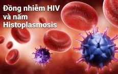 HPV: Nguy Cơ Lây Truyền Qua Tình Dục và Cách Phòng Ngừa Ung Thư Hiệu Quả