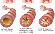 Những Dấu Hiệu Khẩn Cấp Khi Trẻ Sặc Nước: Phải Làm Gì Ngay?