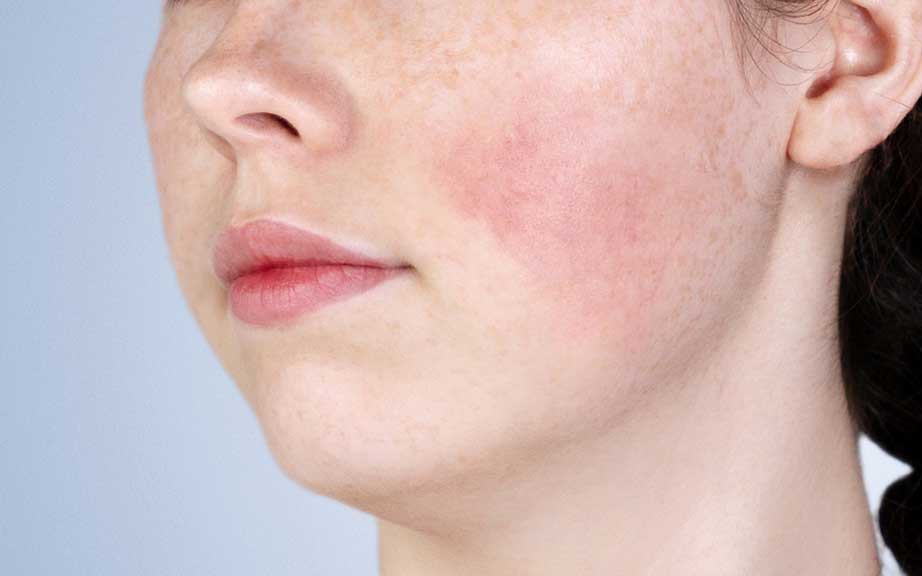retinol-3-17511950954801143668705-0-0-576-922-crop-17511951219821763771574 Thoa retinol quanh vùng mắt có tác dụng gì? - Ảnh 3.