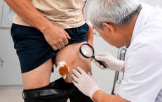 Đề Xuất Độ Tuổi Hiến Tạng Mới Từ Bộ Y Tế: Diễn Biến và Tác Động