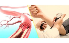 Tại sao ngay cả người lao động khỏe mạnh vẫn nên khám sức khỏe định kỳ