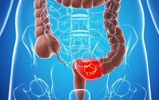 Khi người cao tuổi không thể tiểu tiện: hướng xử trí cấp cứu và chiến lược chăm sóc lâu dài