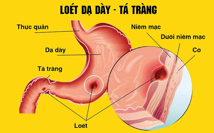 Cây Xấu Hổ: Tác Dụng và Bài Thuốc Truyền Thống