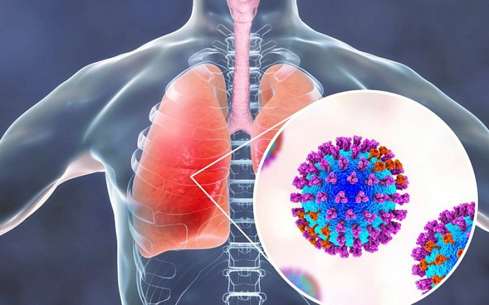 Nhận Diện Sớm Viêm Phổi Do Adenovirus Ở Trẻ Em: Những Dấu Hiệu Cần Quan Tâm
